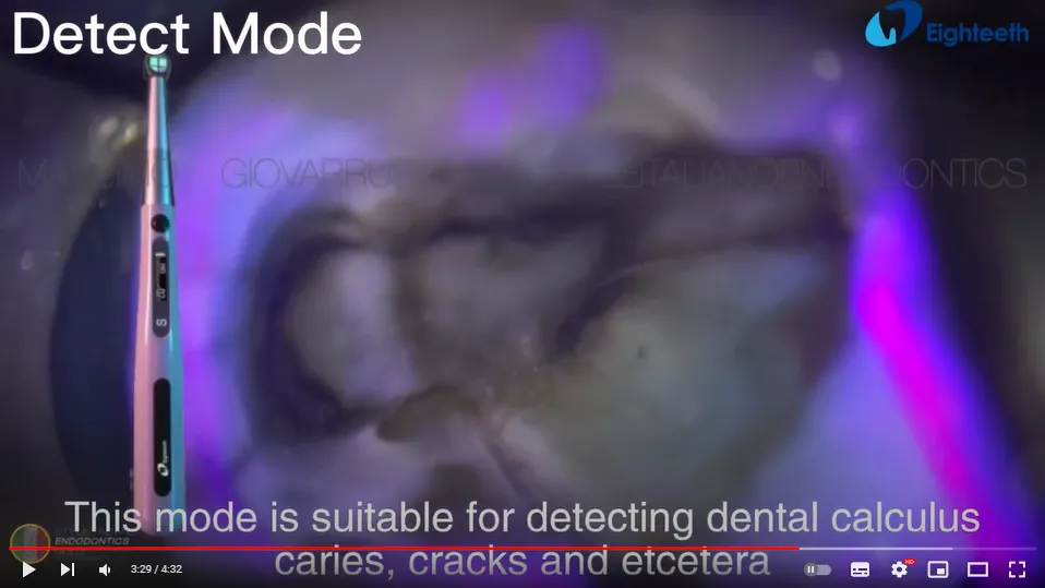 Полимеризационная лампа Curing Pen